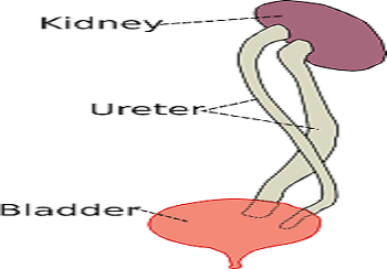 Megaureter, duplex kidney